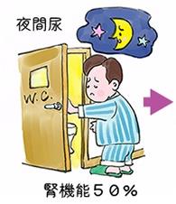 夜間尿のイラスト