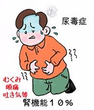 尿毒症のイラスト