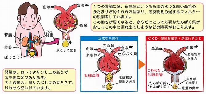 腎臓糸球体イラスト